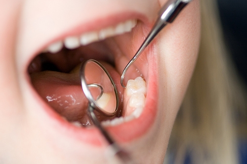 Celiachia: nei bambini, si può scoprire anche dalla bocca