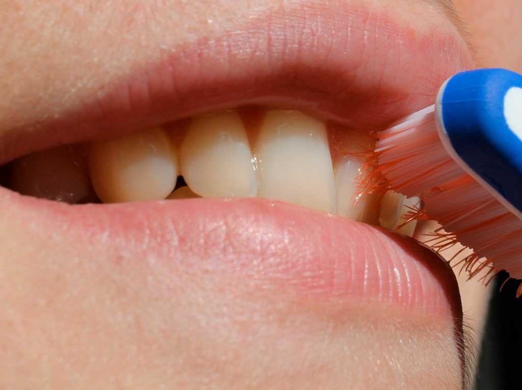 Per i celiaci aumentano i problemi di salute orale