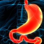 Duodenite: quali sono le cause e come risolvere questa infiammazione intestinale
