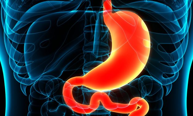 Duodenite: quali sono le cause e come risolvere questa infiammazione intestinale
